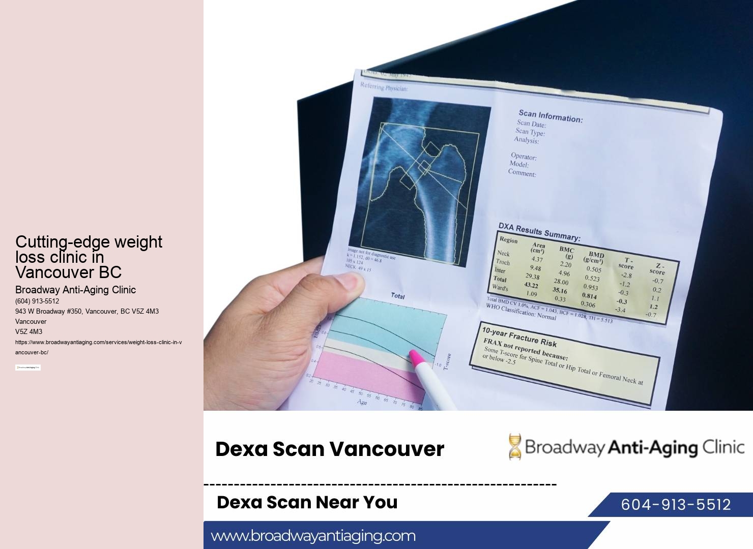 Weight loss programs in Vancouver