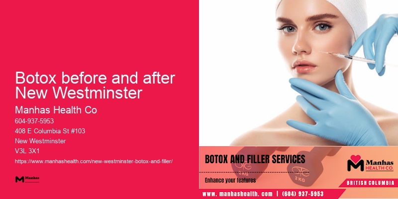 Botox injections cost Botox before and after New Westminster