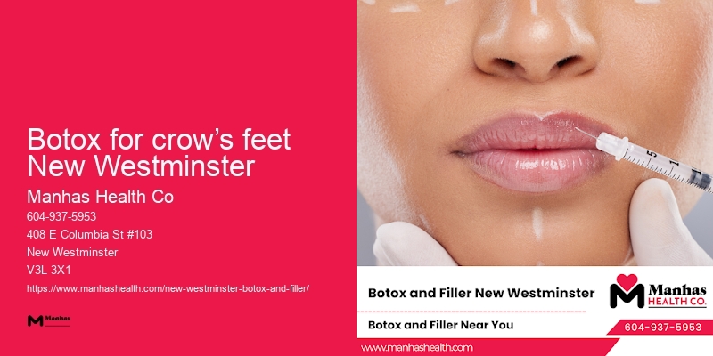 Botox for crow’s feet New Westminster Botox for facial rejuvenation