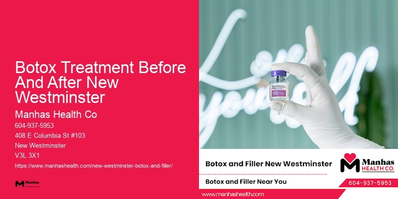 Best Botox doctors Botox Treatment Before And After New Westminster