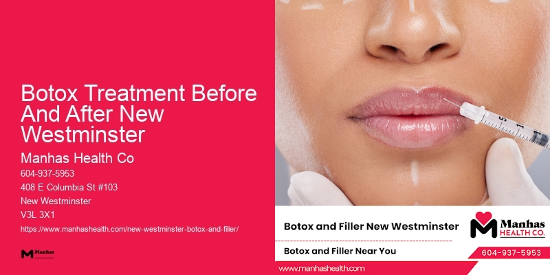 Botox treatment before and after Botox Treatment Before And After New Westminster