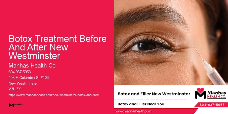 Botox for a smooth complexion Botox Treatment Before And After New Westminster
