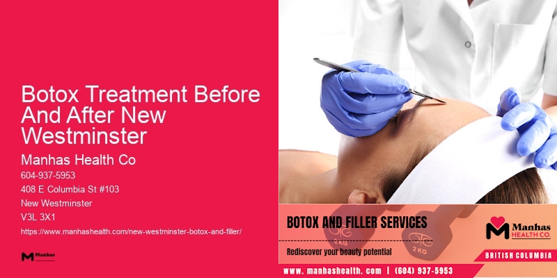 Botox for forehead wrinkle reduction Botox Treatment Before And After New Westminster