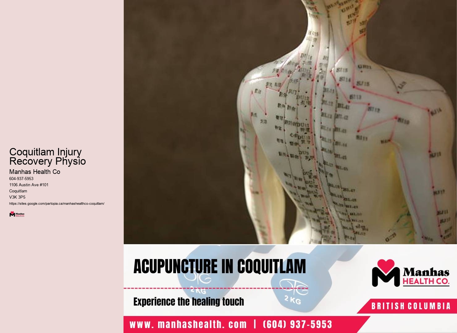Trusted Coquitlam Physiotherapy Experts