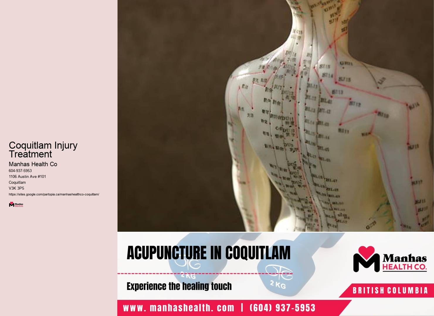 Coquitlam Physio Appointments