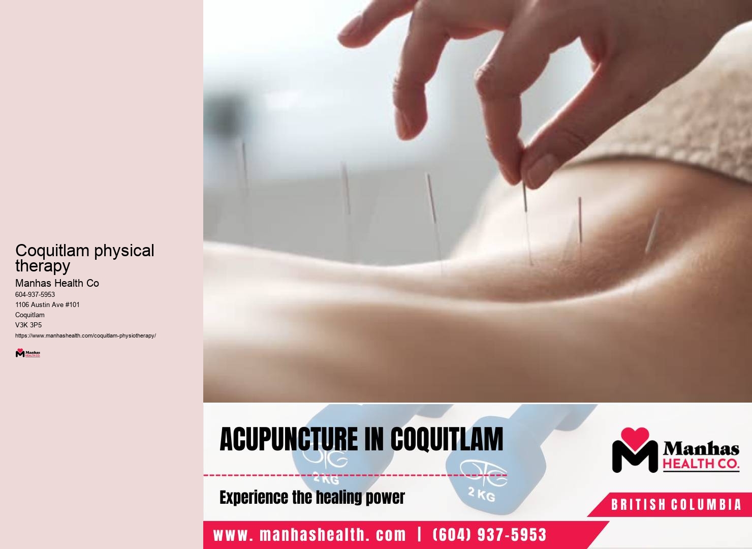 Coquitlam physio assessment